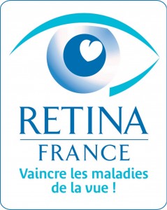 retina